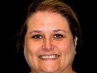 Konig Center for Cosmetic & Comprehensive Dentistry smile photos